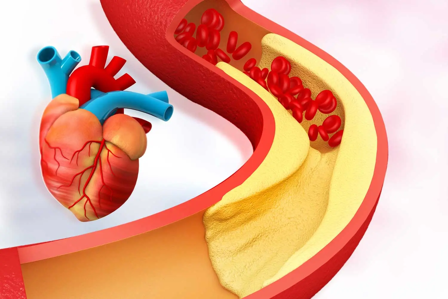 Rising Cholesterol Numbers - Support Heart Health With Diet